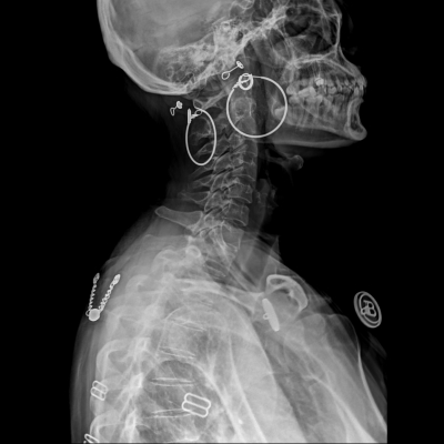 河南客户莅临考察：共鉴医用便携DR技术，引领医疗影像新篇章