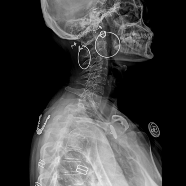 河南客户莅临考察：共鉴医用便携DR技术，引领医疗影像新篇章
