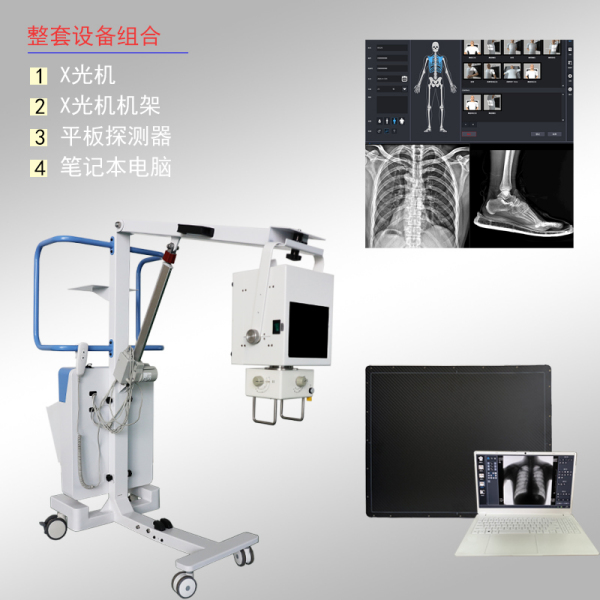 便携式DR X光机在个人诊所的应用与优势
