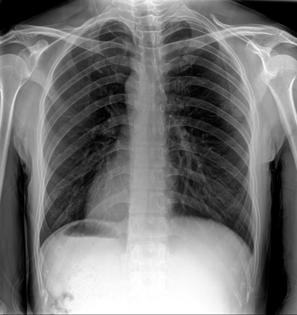 X光设备检查辐射对患者的影响有多大
